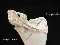 04 Spine : supraspinous, infraspinous, scapula, pectoral girdle, supraspinous fossa, infraspinous fossa