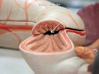 07 Pyloric sphincter : pyloric sphincter, pylorus, stomach, duodenum