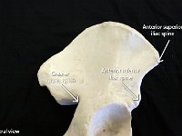 07 Sciatic notch-illian spine-01 : anterior superior iliac spine, anterior inferior iliac spine, greater sciatic notch, pelvic girdle