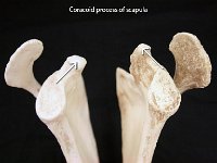 09 Coracoid process of scapula-01 : coracoid process, scapula, glenoid fossa, pectoral girdle