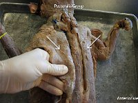 11 Pectoralis group : pectoralis group, chest muscles, ventral surface of chest, cat muscular system