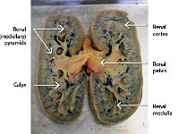 12 Renal pyramids-calyx-rena cortex-pelvis-medulla : renal pyramids, calyx, renal cortex, renal pelvis, renal medulla