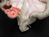 12 Sigmoid colon : sigmoid colon, colon, rectum, descending colon