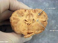 14 white-gray matter : white matter, gray matter, brain, anatomy of sheep brain
