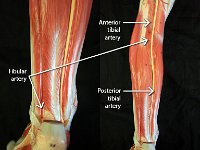 15 Anterior-posterior-tibial-fibular-artery : fibular artery, anterior tibial artery, posterior tibial artery, leg artery