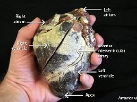 15 LEft-right atrium-left-right-ventricle-apex-anerior interventricular artery-01 : apex, left atrium, right atrium, left ventricle, right ventricle, anterior interventricular artery