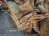 15 biceps-triceps-pronator-brachialis : biceps brachii, triceps brachii, brachialis, pronator Teres