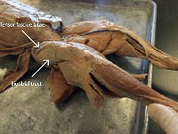 16 tensor fasciae latae-ilitibial tract : tensor fasciae latae, iliotibial tract, lower limb muscle, cat muscular system