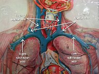 17 Internal-external jugular vein-right-left-subclavian vein : left and right subclavian vein, brachiocephalic veins, veins of the neck and upper limbs