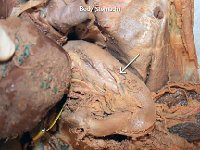 18 Body (stomach) : stomach, body, digestion, cat digestive system