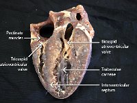 18 Pectinate muscles-Trucuspid-Bicuspid atrioventricular valve-trabeculae carneae-interventricular septum : interventricular septum, pectinate muscles, tricuspid atrioventricular valve, bicuspid atrioventricular valve, trabeculae carnae