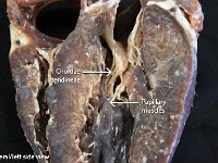19 Chordae tendinae-papillary muscles : papillary muscles, chordae tendinae, pig/sheep heart, internal structures