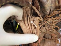 19 Pyloric sphincter : rugae, stomach, internal surface, cat digestive system
