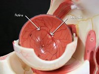 20 Optic disc-retina : optic disc, retina, optic nerve, eye anatomy