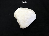 22 Patella-01 : patella, kneecap, anterior, lower limb