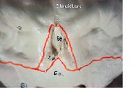 25 Ethmoid Bone : ethmoid bone, cranial bone, skull