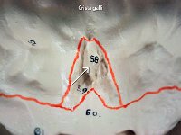 26 Crista galli-01 : crista galli, ethmoid bone, cranial bone, skull