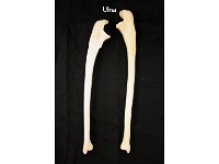 26 Ulna : ulna, forearm, upper limb