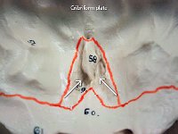 27 Cribiform plate-01 : cribriform plate, crista galli, cranial bone, skull