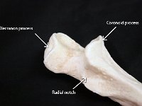 28 Coronoid-Olecranon process+radial notch-01 : olecranon process, coronoid process, and radial notch, upper limb