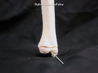 29 Styloid process of ulna : styloid process of ulna, head of the ulna, medial side, upper limb