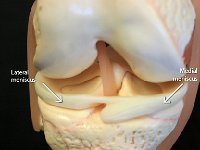 31 Meniscus : lateral meniscus, medial meniscus, knee joint, lower limb