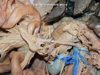 34 Superior mesenteric artery : superior mesenteric artery, abdominal aorta, celiac trunk, cat circulatory system