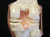 35 Posterior cruciate ligament : posterior cruciate ligament, knee joint, posterior, lower limb