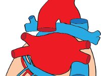 Cardiovascular System, coronary pathway (vessels)