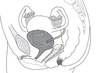 Female Reproductive  Female Reproductive.jpg