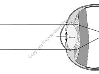 Special Senses, light traveling through human eye