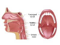 Tonsils