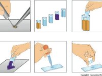TrichromeStain : trichrome stain, slide