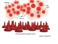Airy Defraction Pattern  airy disc, airy patters, diffraction, Rayleigh Criterion : airy disc, airy patters, diffraction, Rayleigh Criterion