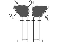 Antibody  Epitope, Heavy chain, Light chain, variable region, constant region : Epitope, Heavy chain, Light chain, variable region, constant region