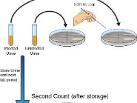 Urine Storage Experiment  urine, store, sample, infection, infected urine, uninfected urine, loop, rod transfer,  petri dish, first count, second count