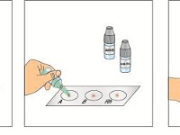 Blood Type Test  Chromosome, Gene, Rhesus Factor, Blood, cofactor, antibody, alleles