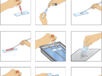 Capsule Stain  acid stain, base stain, capsule, slide, bacteria, polysaccharide, polypeptide