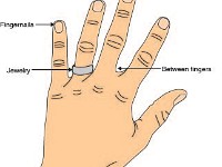 Microbial Hot Spots  germs, bacteria, microbes, accumulate, sanitize, wash, virus, ring, fingernails