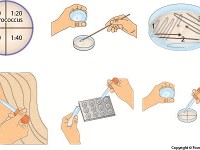 Lysozyme Experiment  gram stain, gram positive, gram negative, enzyme, innate, immune system, bacteria, sensitivity, dropper, coccus, petri dish