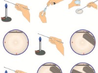 Streak Plate Technique  strain, bacteria, petri dish, isolate, bacteria, microbe, streak, colony